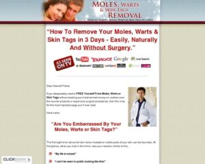 Moles, Warts & Pores and skin Tags Removal – How To Properly & Forever Remove Moles, Warts & Skin Tags
