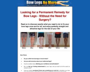 Bow Legs No More – How to Straighten Your Legs With out Surgical procedures!